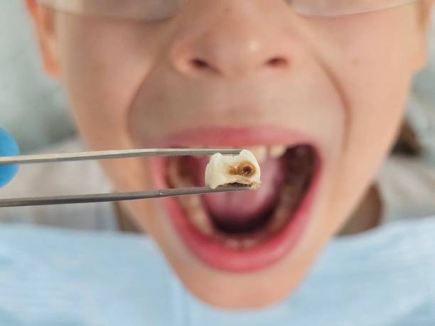 Best After-Hours Emergency Dentist in Cajahs Mountain, NC
