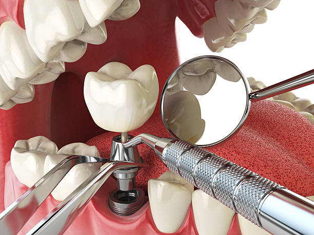 Best Weekend Emergency Dentist in Cajahs Mountain, NC